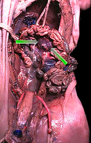 mesentery