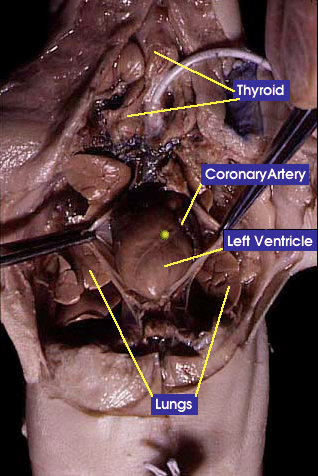 Heart and lungs