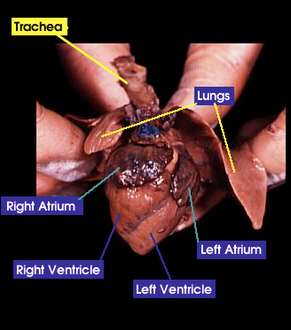 heart and lungs removed