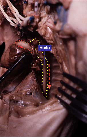 Aorta