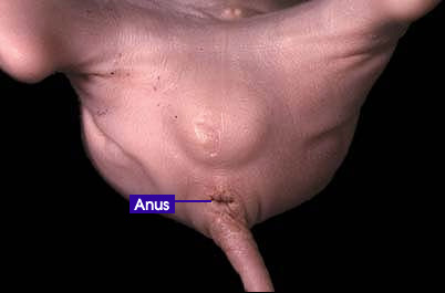 Pics Of Womens Anus