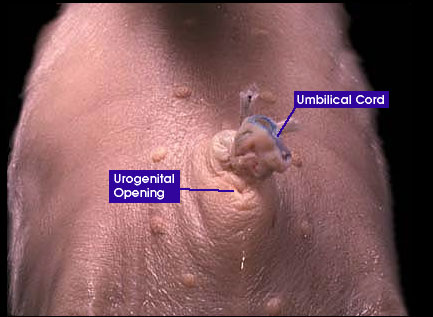 Umbilical area