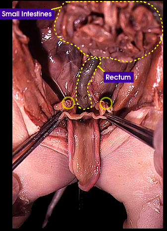 reproductive system - female