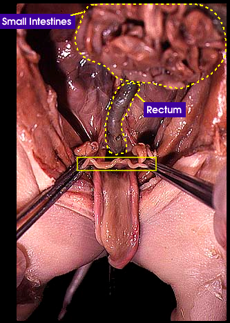 reproductive system - female