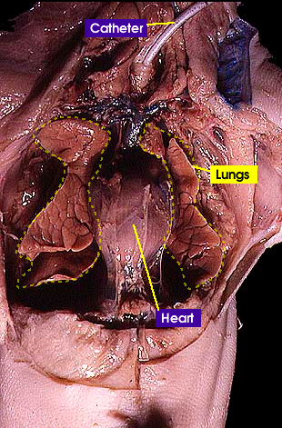 lungs