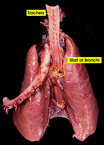 lungs (removed)