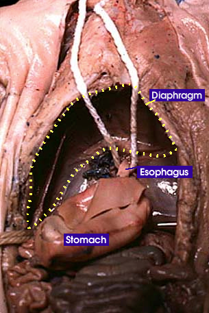 Remove the Liver