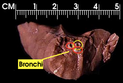 lung cross section