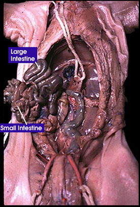 Rectum, umbilical arteries, pancreas