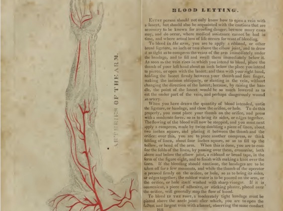 19th-century diagram of arteries in a human forearm